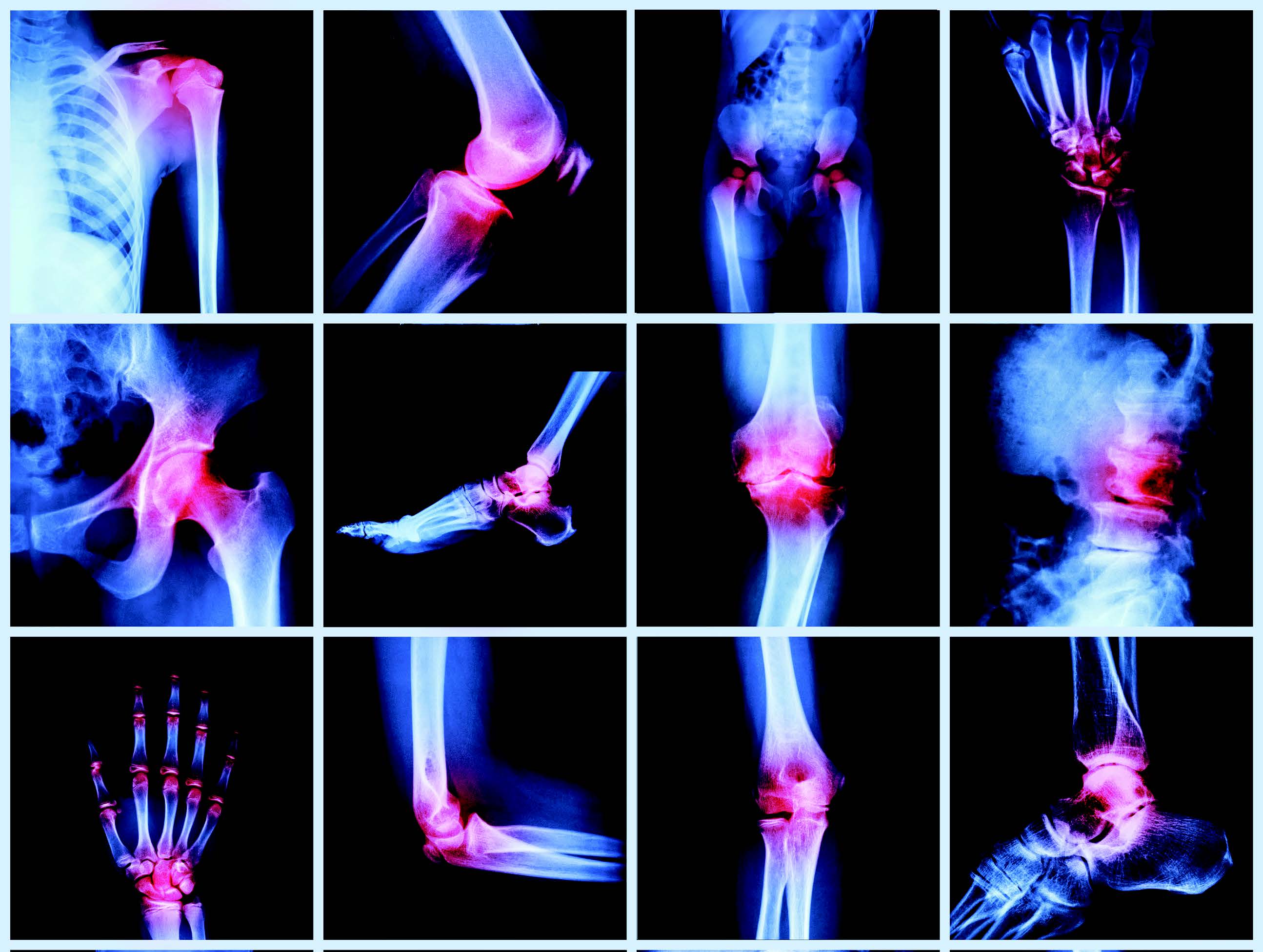 RHEUMATOLOGY & ARTHRITIS