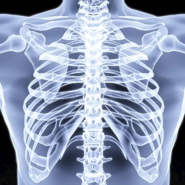 Digital X-Ray